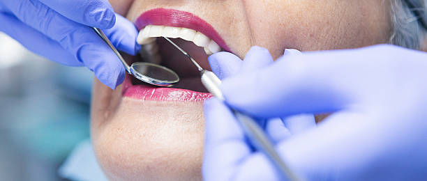 Best After-Hours Emergency Dentist in Elliston, VA